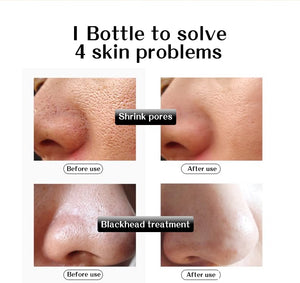 Skin Care shrink pores Anti Aging Intensive Lifting Firming & Anti Wrinkles