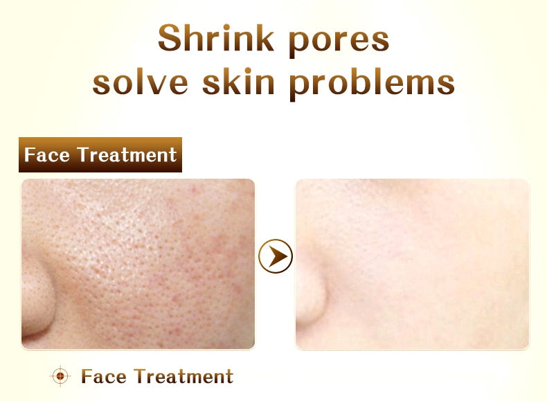 Skin Care shrink pores Anti Aging Intensive Lifting Firming & Anti Wrinkles