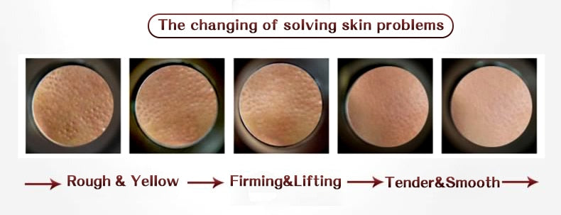 Skin Care shrink pores Anti Aging Intensive Lifting Firming & Anti Wrinkles